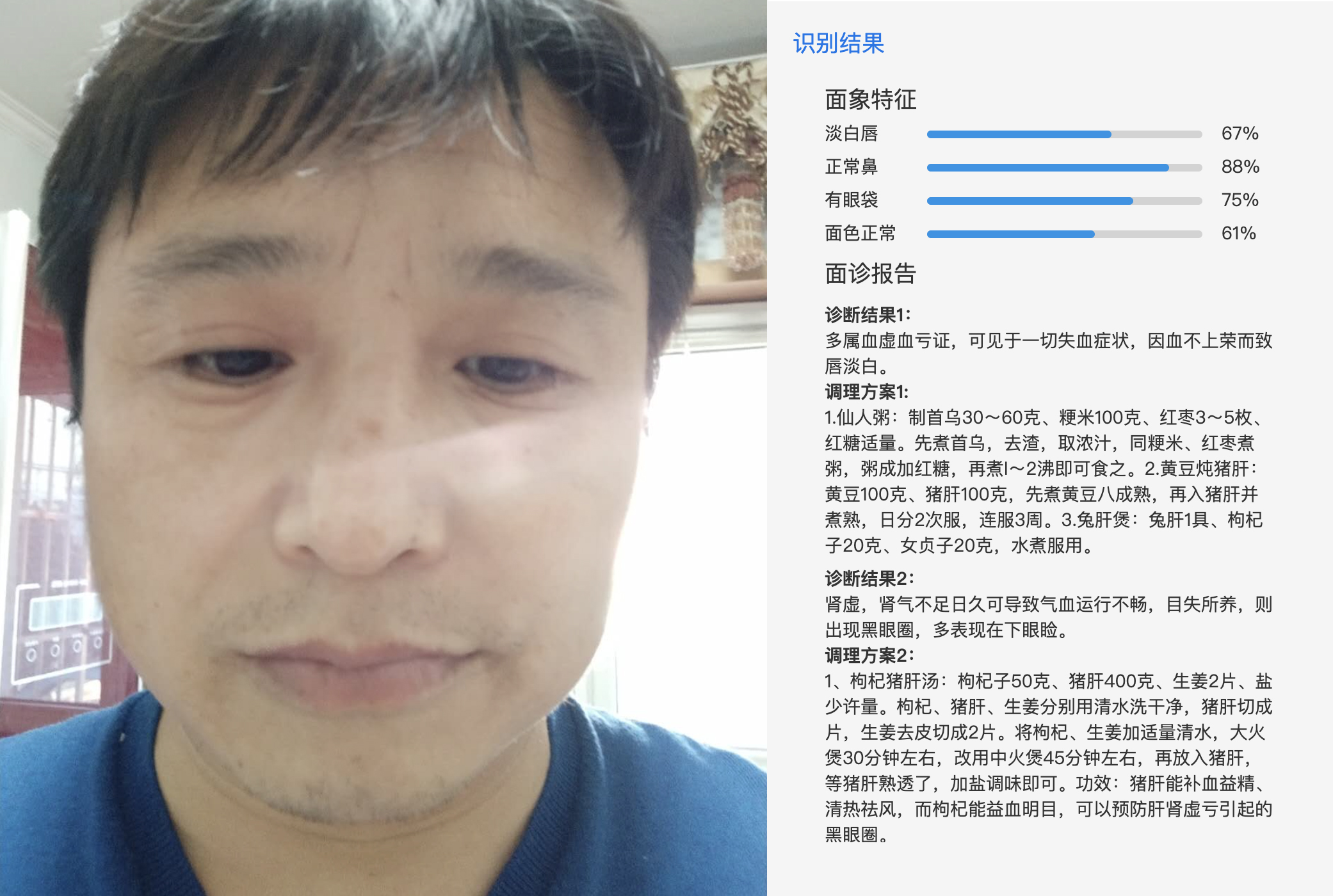 AI面诊 API 接口示意图